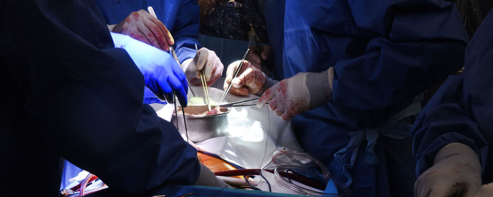 Ca phẫu thuật ghép tim lợn cho người của các bác sĩ phẫu thuật tại Trung tâm Y tế Đại học Maryland - Sputnik Việt Nam, 1920, 24.02.2023