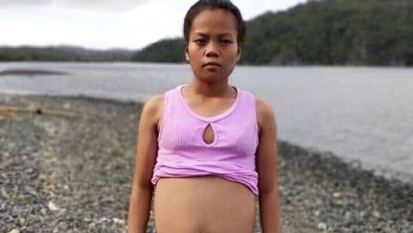 Trong suốt 7 tháng, bụng của Kimberly, 17 tuổi, ngày càng phình to, và cân nặng của cô tăng hẳn 10kg. - Sputnik Việt Nam