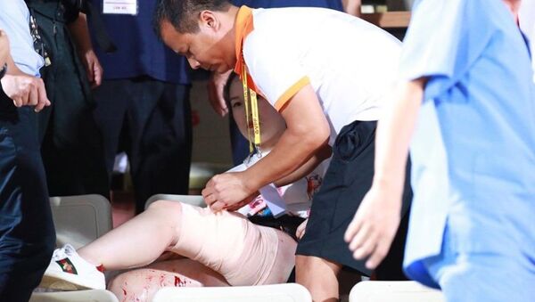 Fan nữ bị bỏng nặng vì pháo sáng - Sputnik Việt Nam