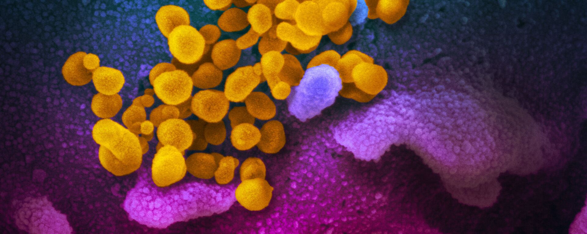 Ảnh màu của chủng coronavirus mới SARS-CoV-2 - Sputnik Việt Nam, 1920, 12.01.2021